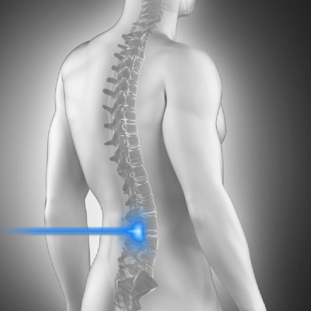 Class 4 laser therapy directed into the lumbar spine